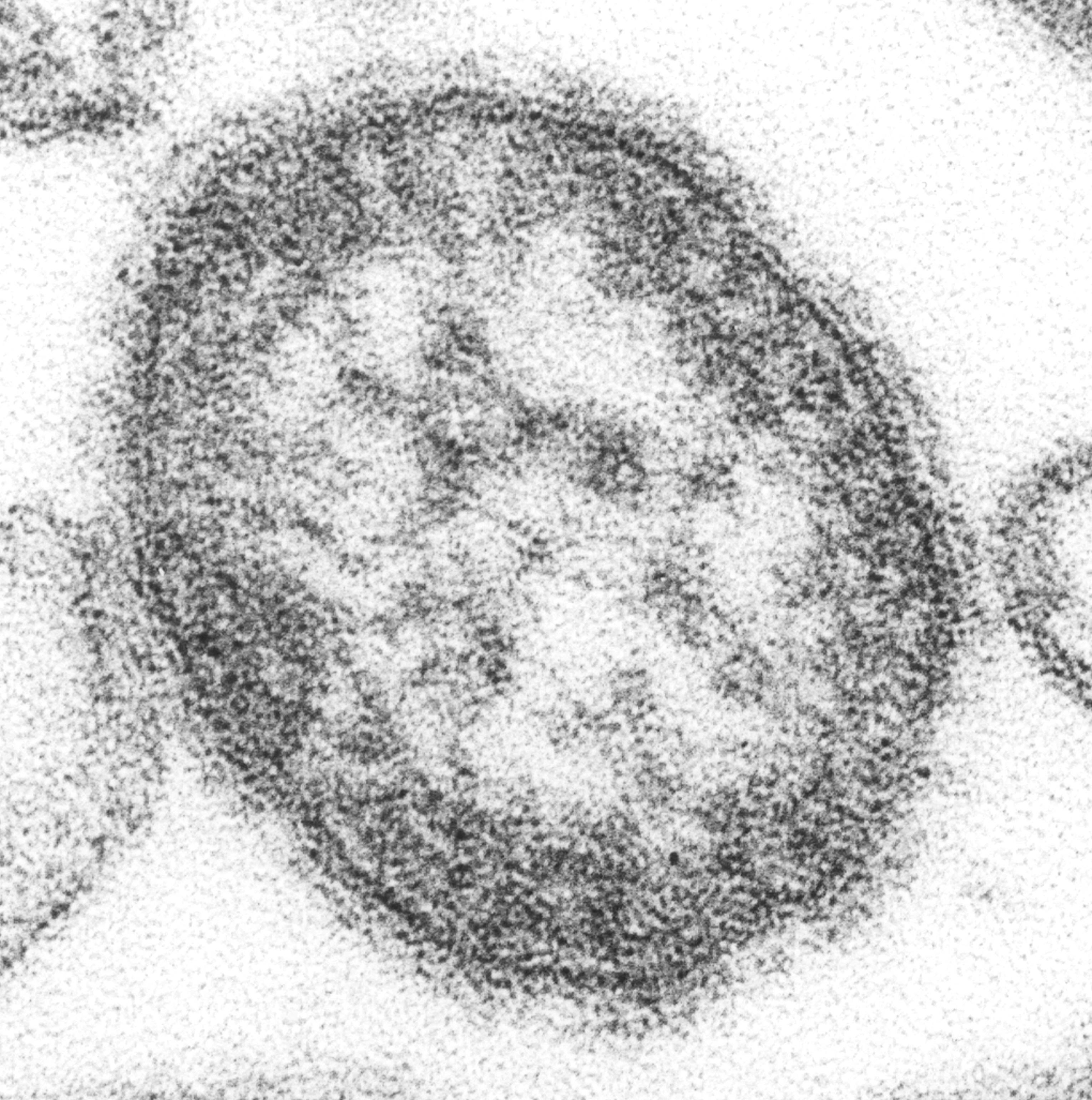 CDC transmission electron micrograph of a measles virus particle; scientific file image, not a Manitoba patient sample